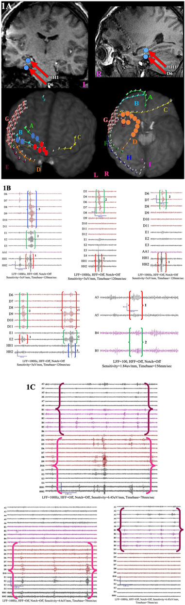 Networks through the lens of high-frequency oscillations